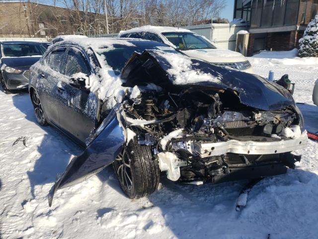 ACURA TLX TECH 2016 19uub3f50ga001297