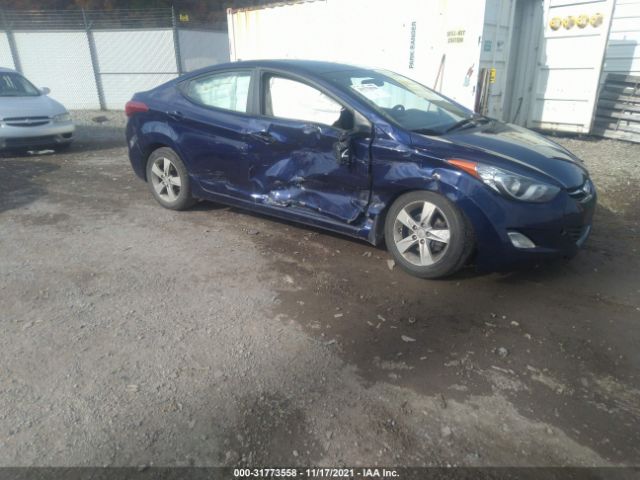 HYUNDAI ELANTRA 2013 5npdh4ae2dh331649