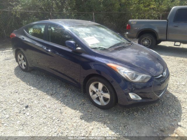 HYUNDAI ELANTRA 2013 5npdh4ae2dh413980