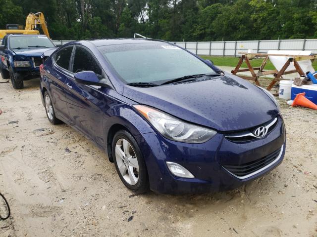 HYUNDAI ELANTRA GL 2013 5npdh4ae7dh375761