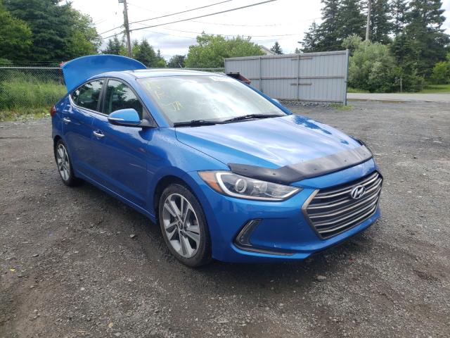 HYUNDAI ELANTRA SE 2017 kmhd84lf9hu171959