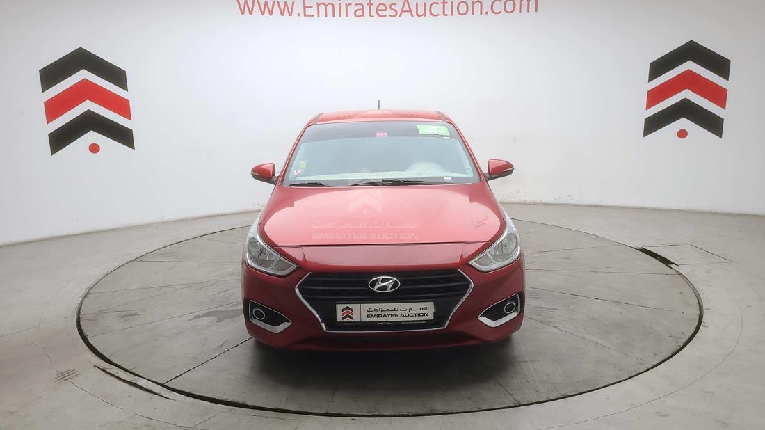 HYUNDAI ACCENT 2020 malc741c7lm192360